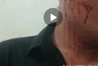 Foto: Kondisi Korban Sesaat setelah Pengeroyokan.