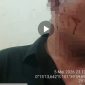 Foto: Kondisi Korban Sesaat setelah Pengeroyokan.