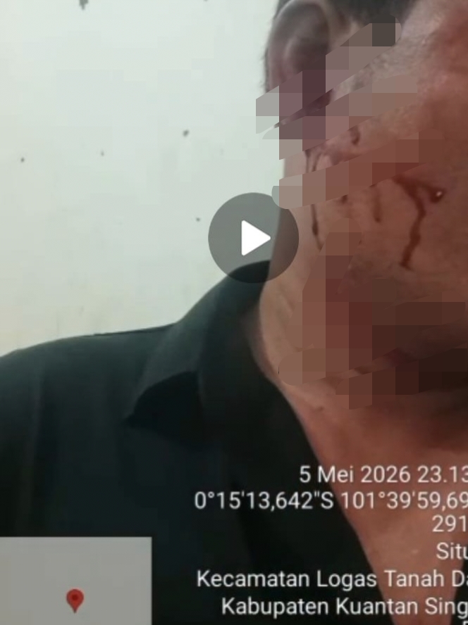Foto: Kondisi Korban Sesaat setelah Pengeroyokan.